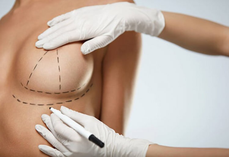 Can Breast Reduction Surgery Make Your Breasts Perky?