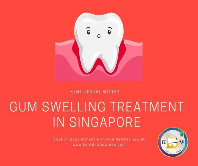 Treatment for Gum Swelling in Singapore - Kent Dental Works