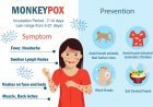 Monkeypox Virus in Pakistan